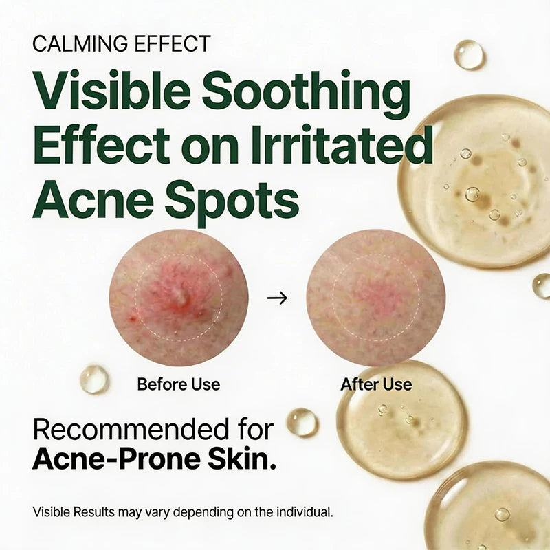 Centella Asiatica Soothing Serum Rapid Hydrating Calming Serum  Advanced Barrier Repair for Sensitive Skin Korean Skin Care