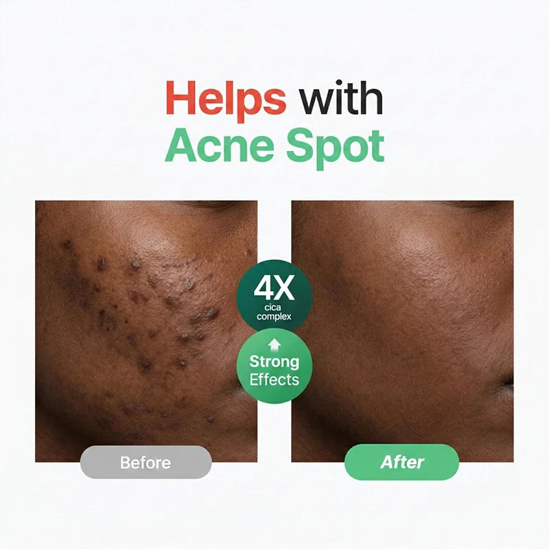 Centella Asiatica Soothing Serum Rapid Hydrating Calming Serum  Advanced Barrier Repair for Sensitive Skin Korean Skin Care