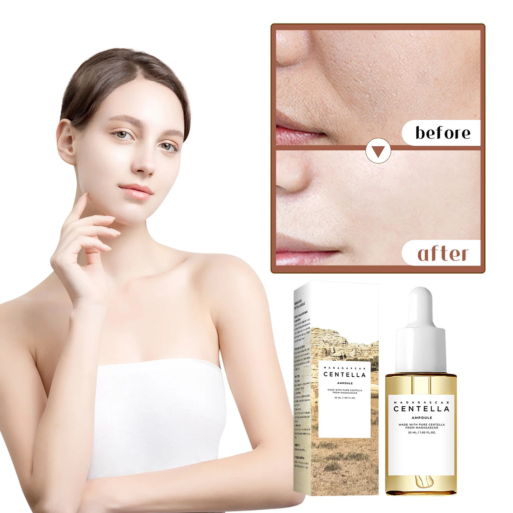 Madagascar Centella Ampoule 55ml – Pure Centella Asiatica Extract for Intense Hydration, Calming Redness & Sensitive Skin Care