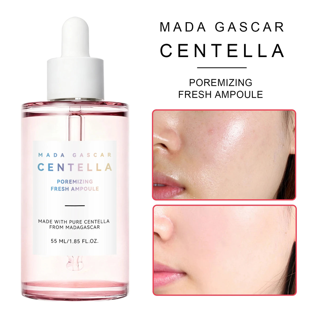 Madagascar Gotu Kola Calming Essence 55ml - For Sensitive & Acne-Prone Skin, Reduces Breakouts & Provides Deep Hydration.