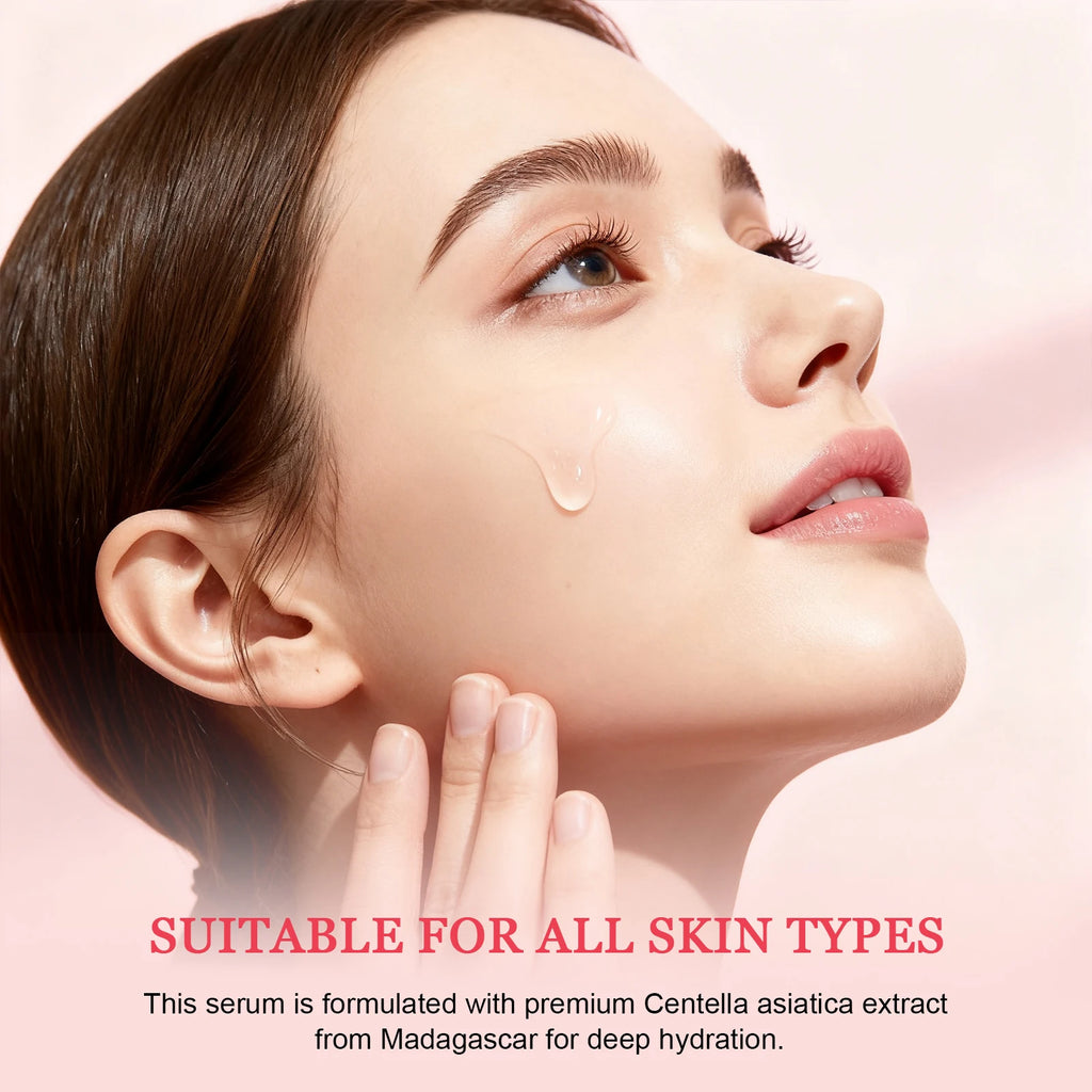 Madagascar Gotu Kola Calming Essence 55ml - For Sensitive & Acne-Prone Skin, Reduces Breakouts & Provides Deep Hydration.